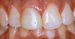 Dental Partners Patient Before Photo