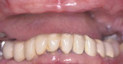 Dental Partners Patient Before Photo
