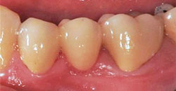 Dental Partners Patient After Photo